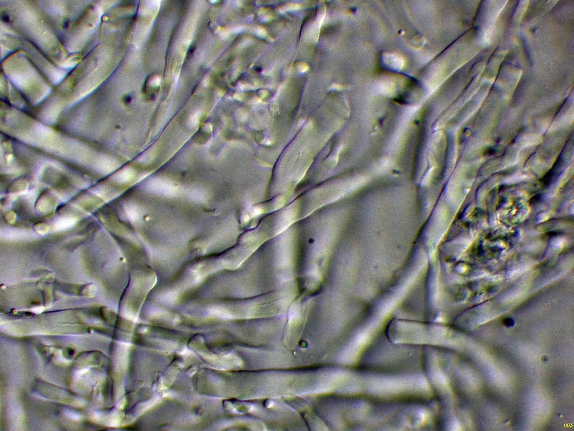 Microscopía de Trametes hirsuta - 10 - Hifas KOH-003